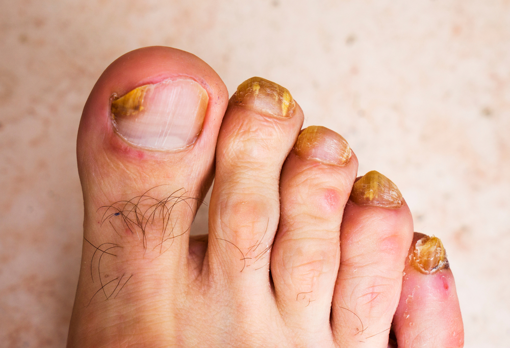  6. マニキュアの染色